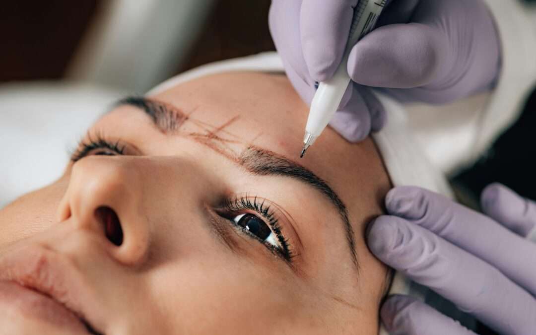 Trasplante de Cejas
