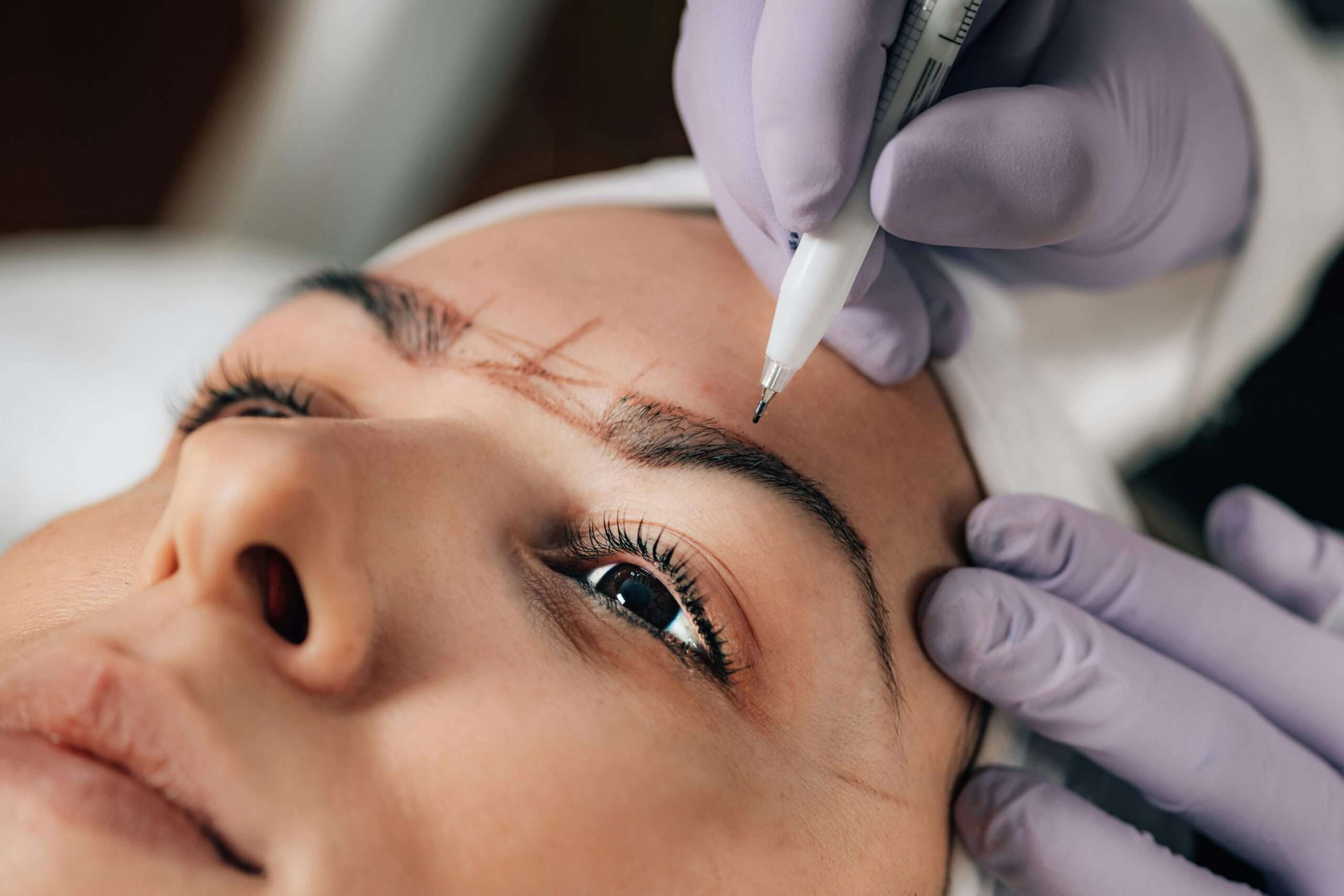 Trasplante de cejas Majestuoso Clinic Santo Domingo diseño facial