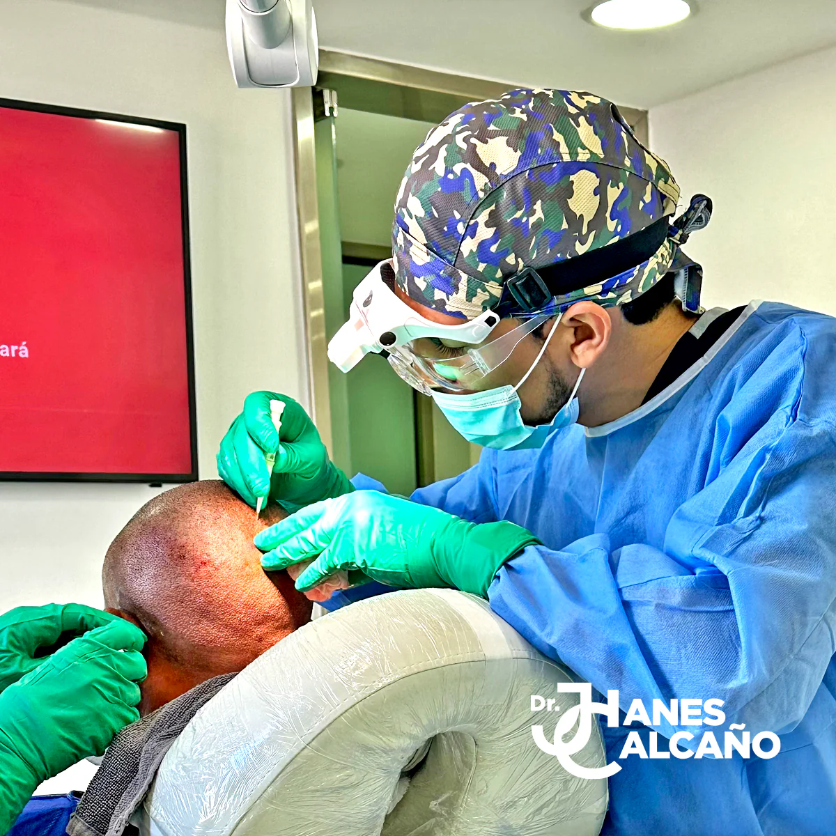 Dr. Cálcanos especialista en trasplante capilar FUE-DHI República Dominicana